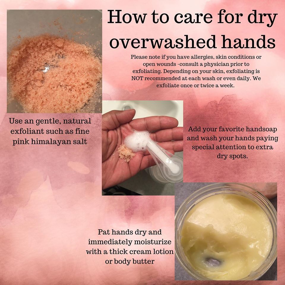 How to Care for Over Washed Hands